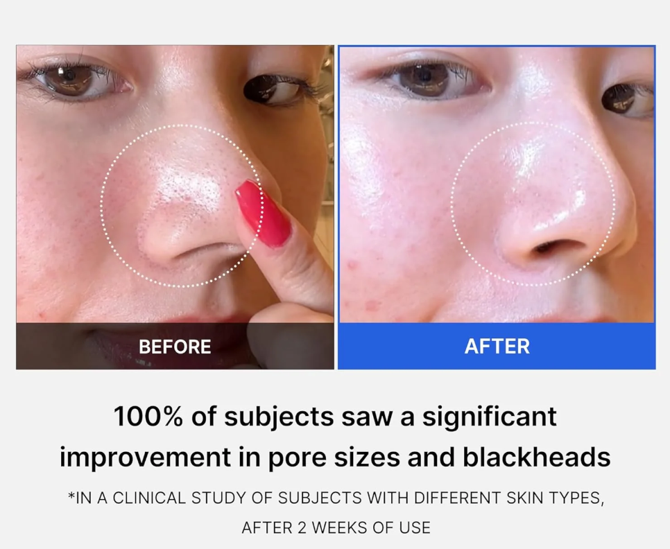 Medicube Zero Pore Pads